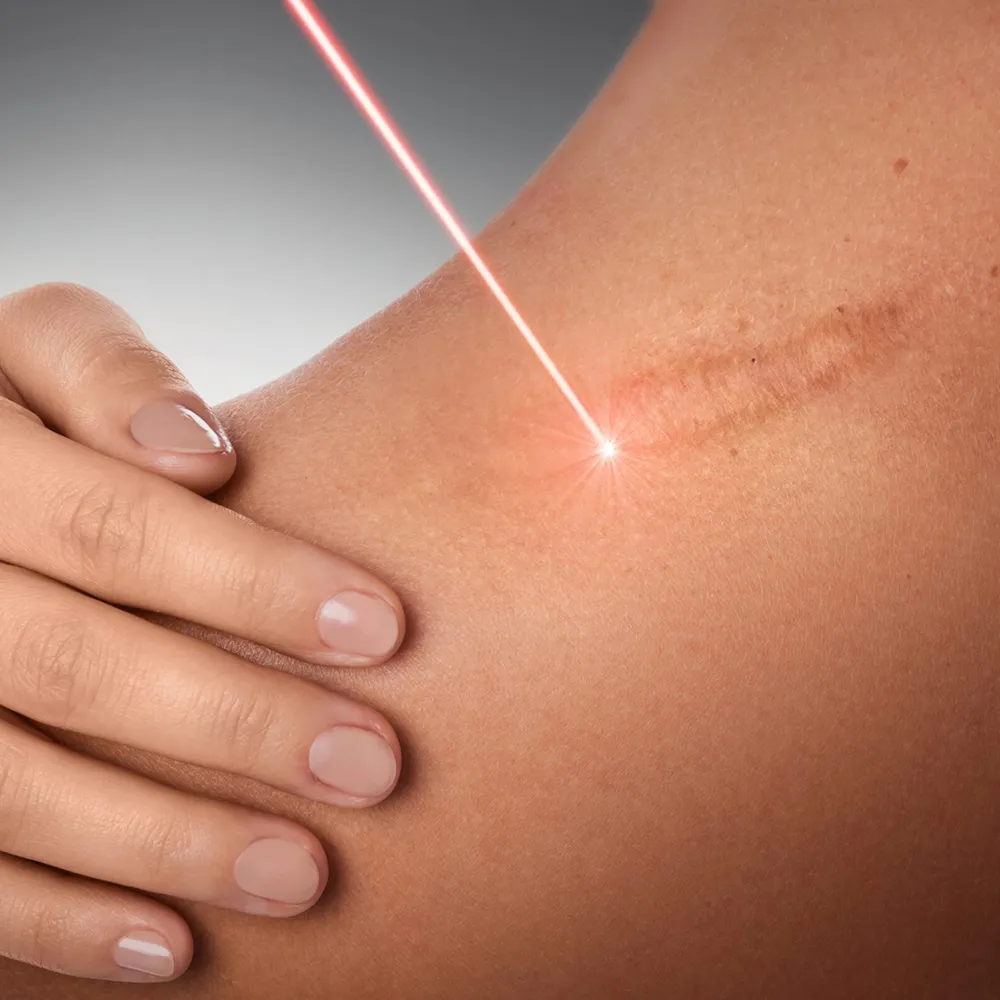 behandlung hautanomalien potsdam 2